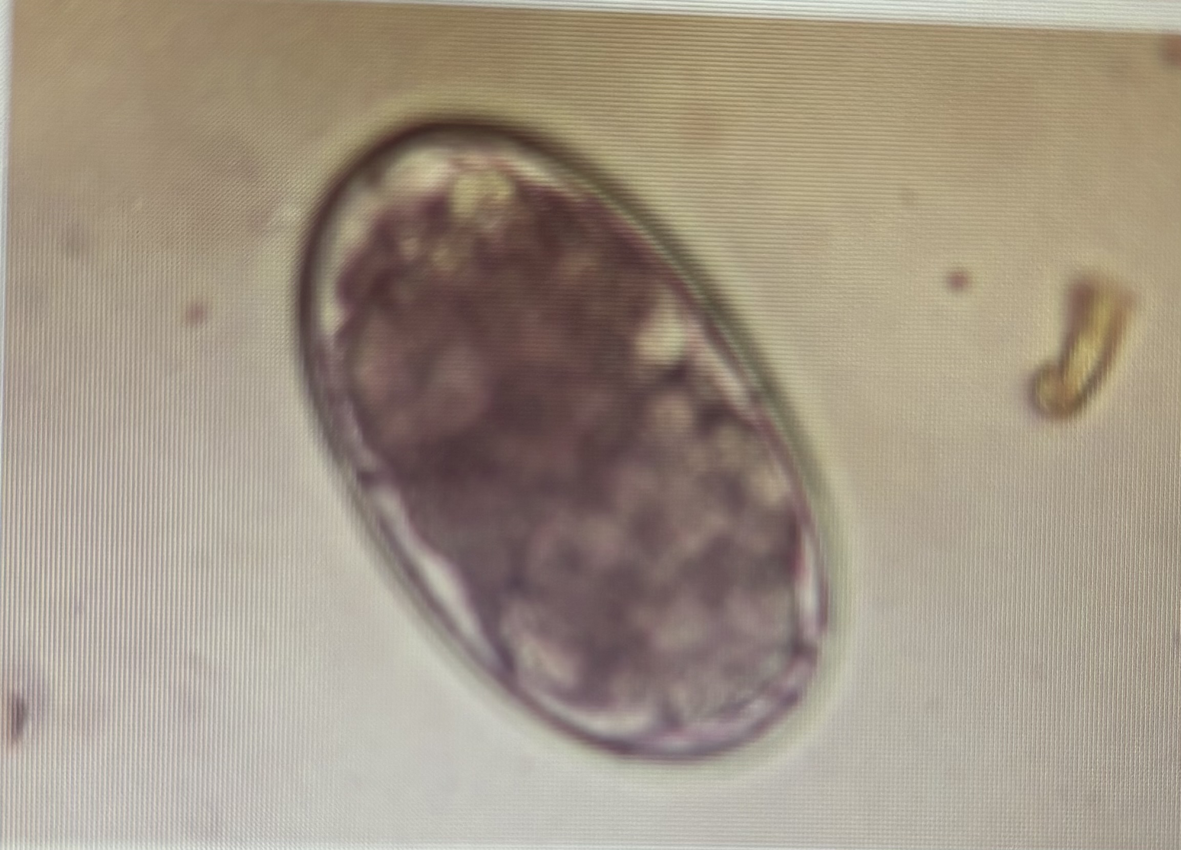 <p>Host species ruminants</p><p>Regardless of size or species, ova are nearly identical</p>