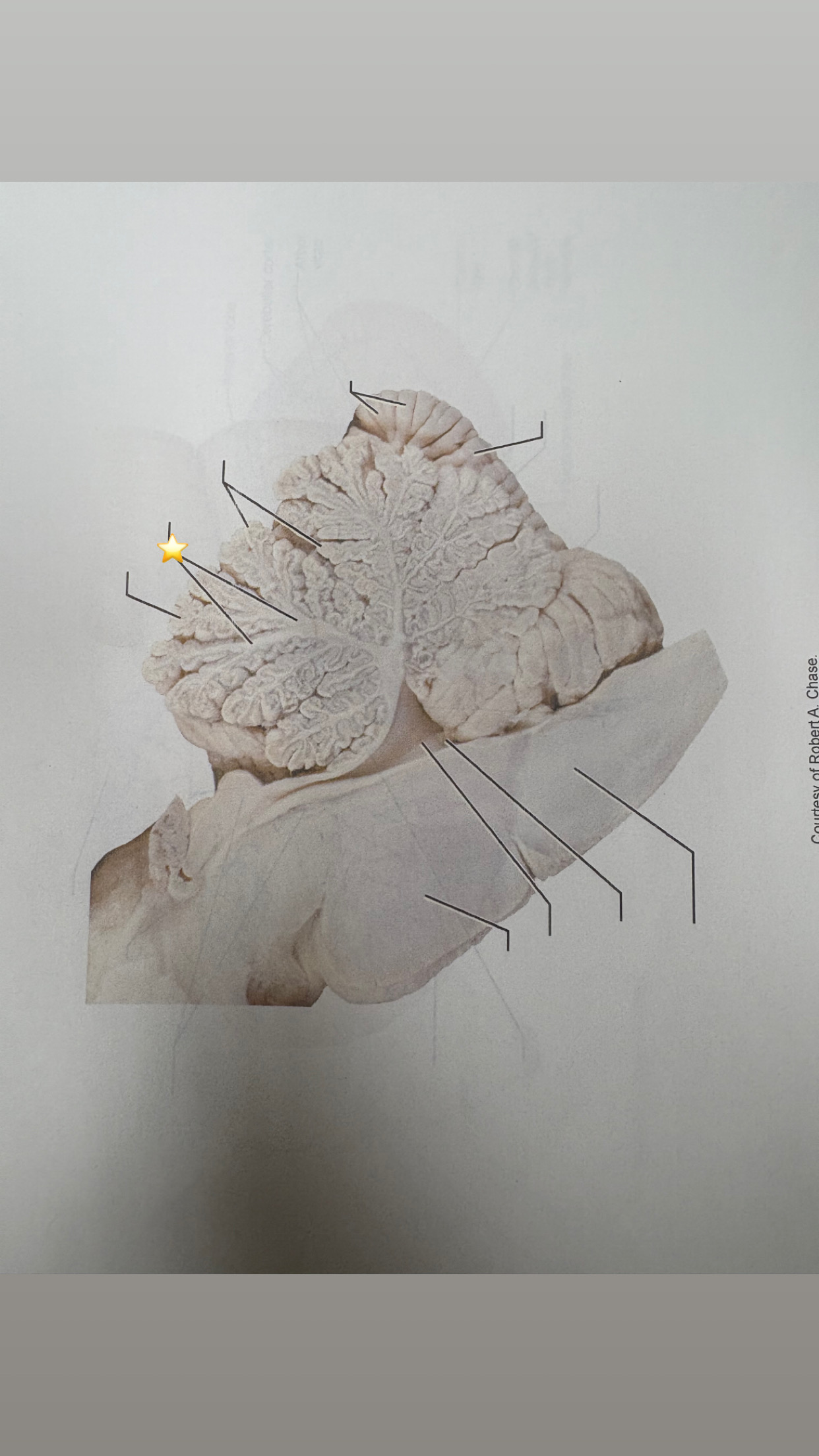 <p>name the starred structure</p>