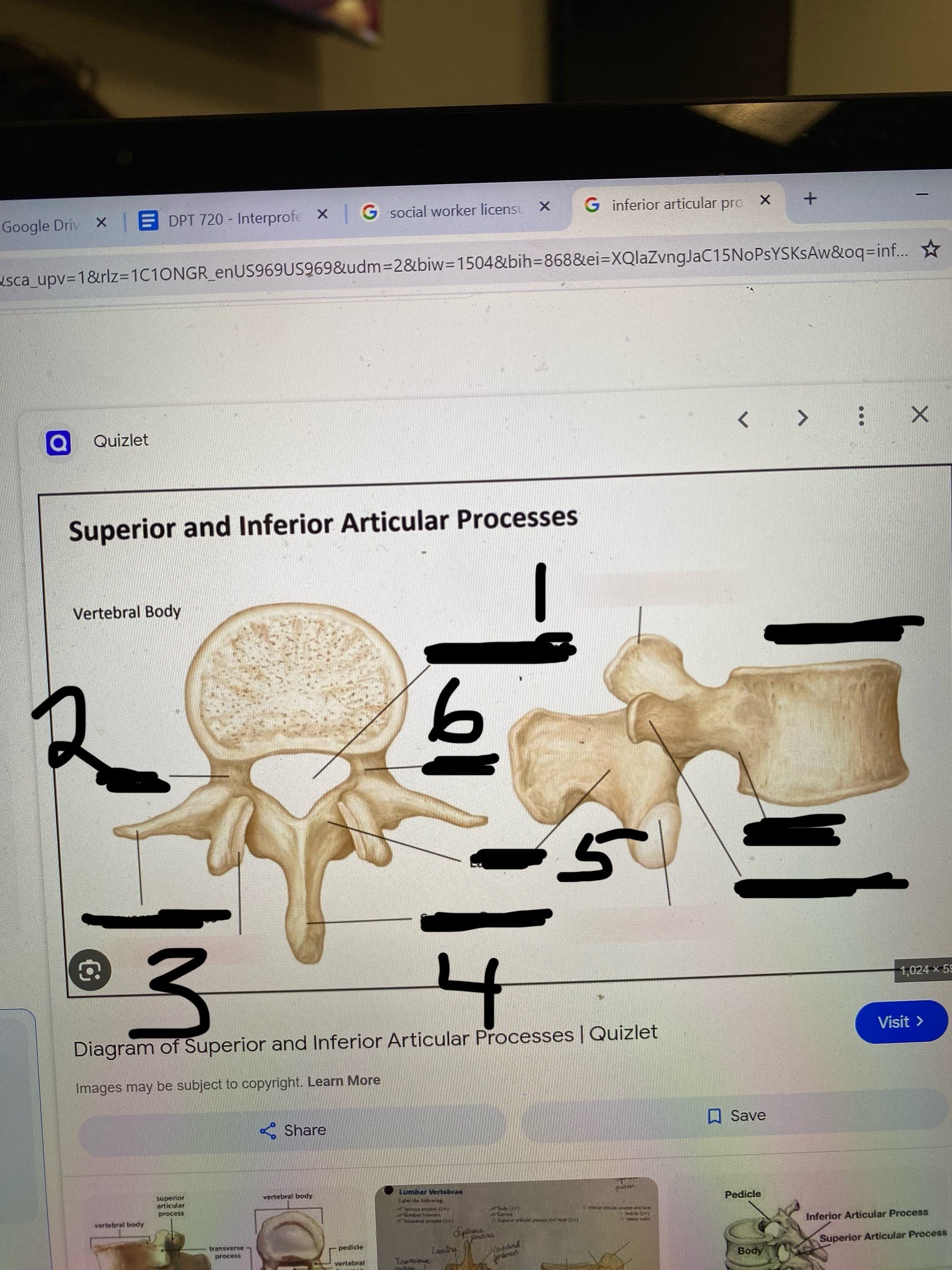 <p>What part of the vertebrae is number 1</p>