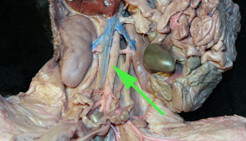 <p><span>what is the green arrow pointing at? //</span><strong>abdominal aorta</strong></p>