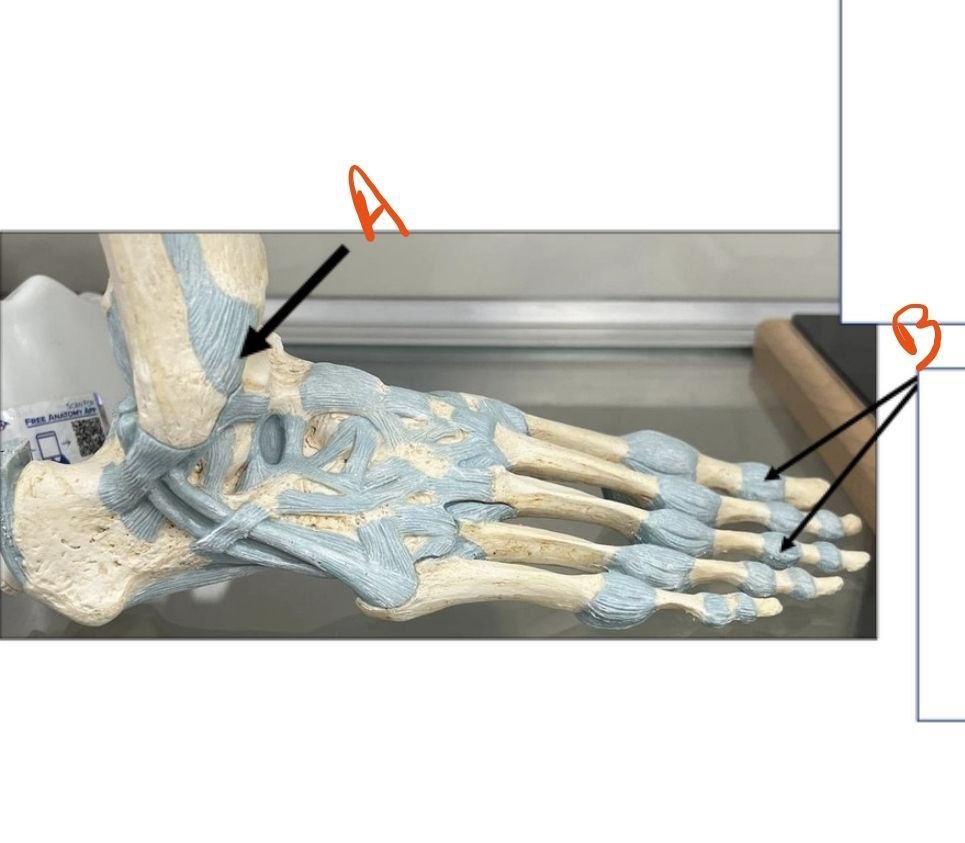 <p>Identify the joints in this picture and classify them</p>