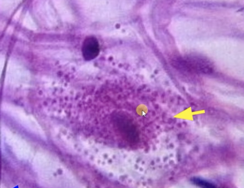 <p>Mast cell </p>