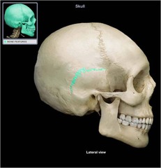 <p>between parietal bone and temporal bone on side of the skull, bordered in back by occipital bone</p>