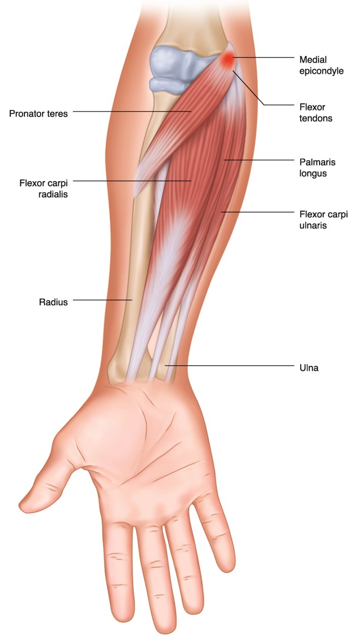 <p>Flexor - medial epicondyle of humerus</p><p>Extensor - lateral epicondyle of humerus</p>