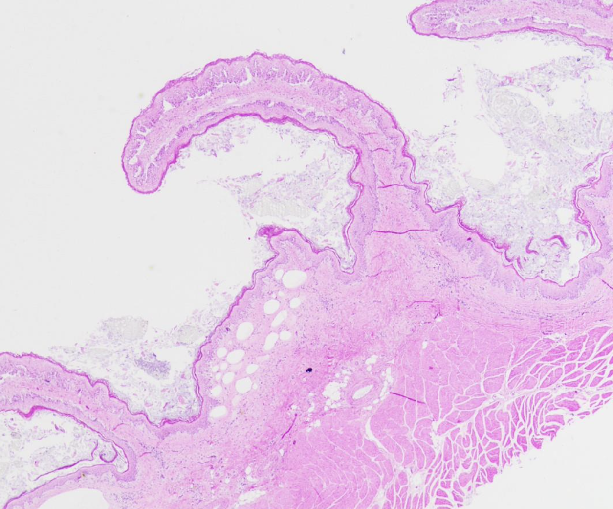   	 		 		 	 	 		

• **Rumen papillae** are projections of the tunica mucosa: they have a **core of lamina propria connective** t**issue with no muscularis mucosae** 

 	 