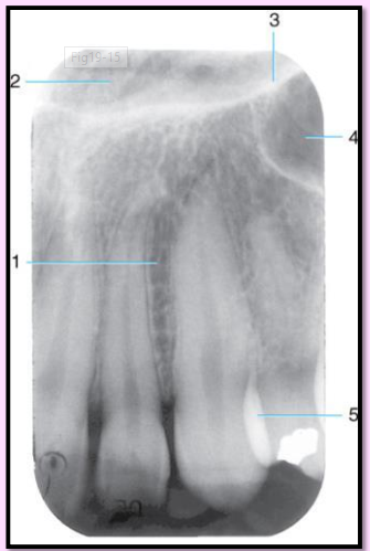 <p>Label all the structures 1-5 of the Maxillary canine area. </p>