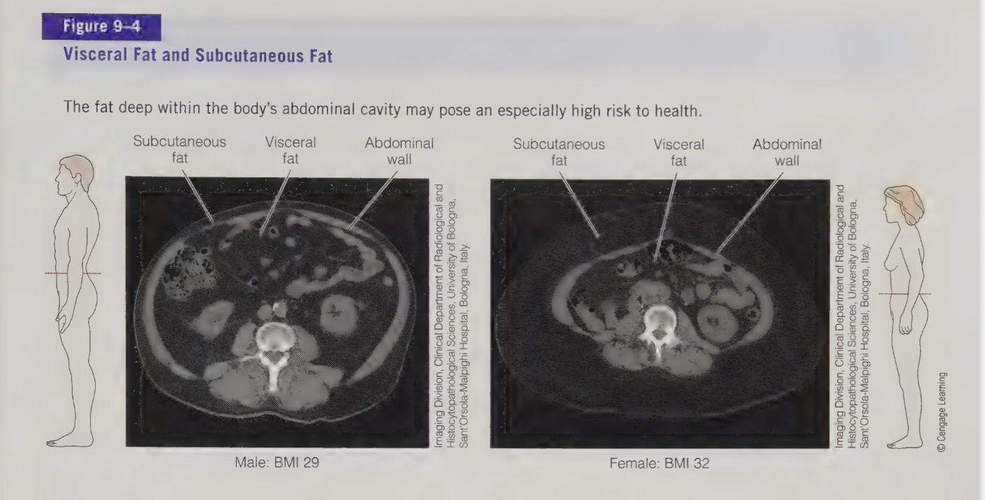 <ul><li><p>Fat carried around the abdomen/stomach area (apple shape).</p></li></ul><p></p>