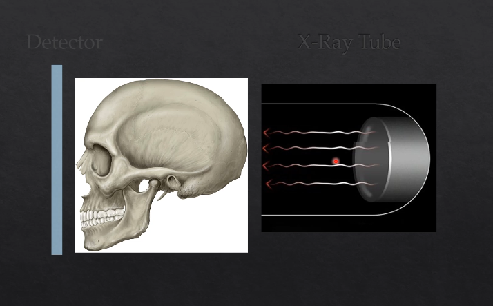 <p>what happens if you pass the Xrays from directly behind the patient?</p>