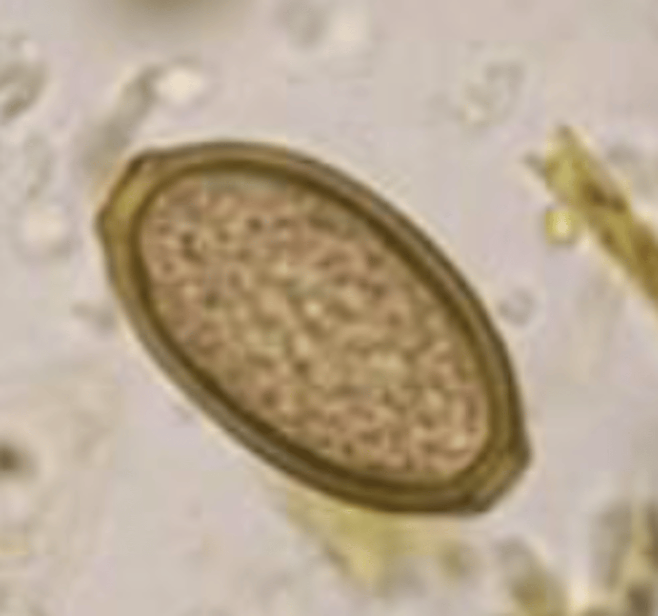 <p>Bladderworm of dogs and cats</p>