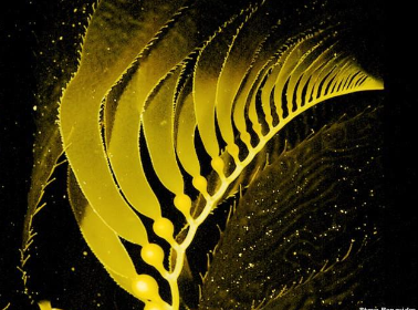 <p>What are pneumatocysts?</p>