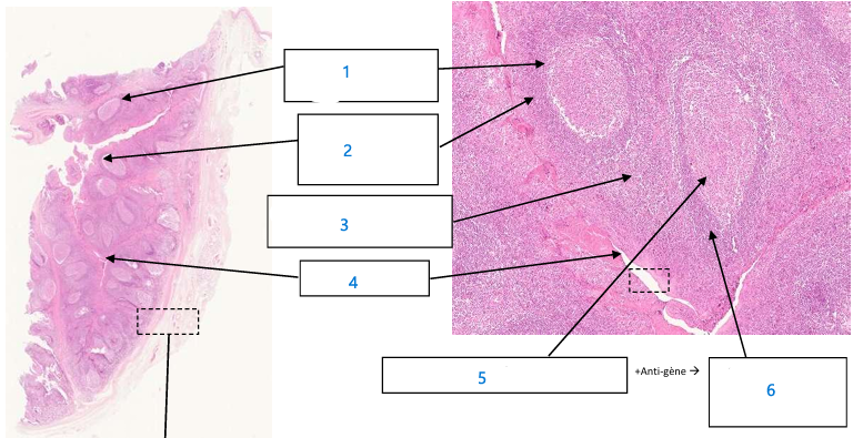 <p>4 amygdales palatines</p>