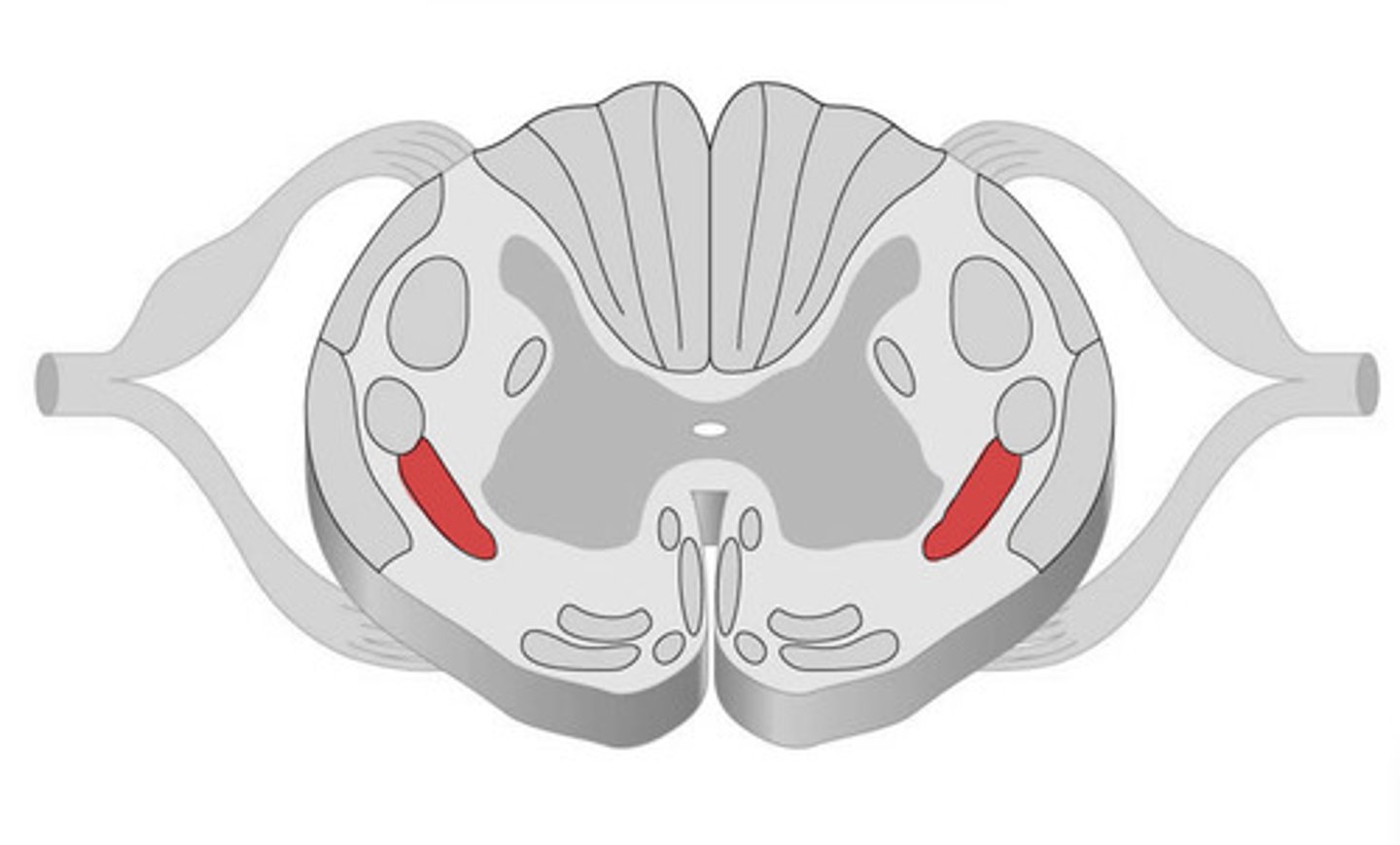 <p>Part of spinothalamic pathways that transmits pain and temperature.</p>