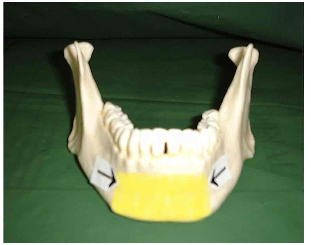 term image