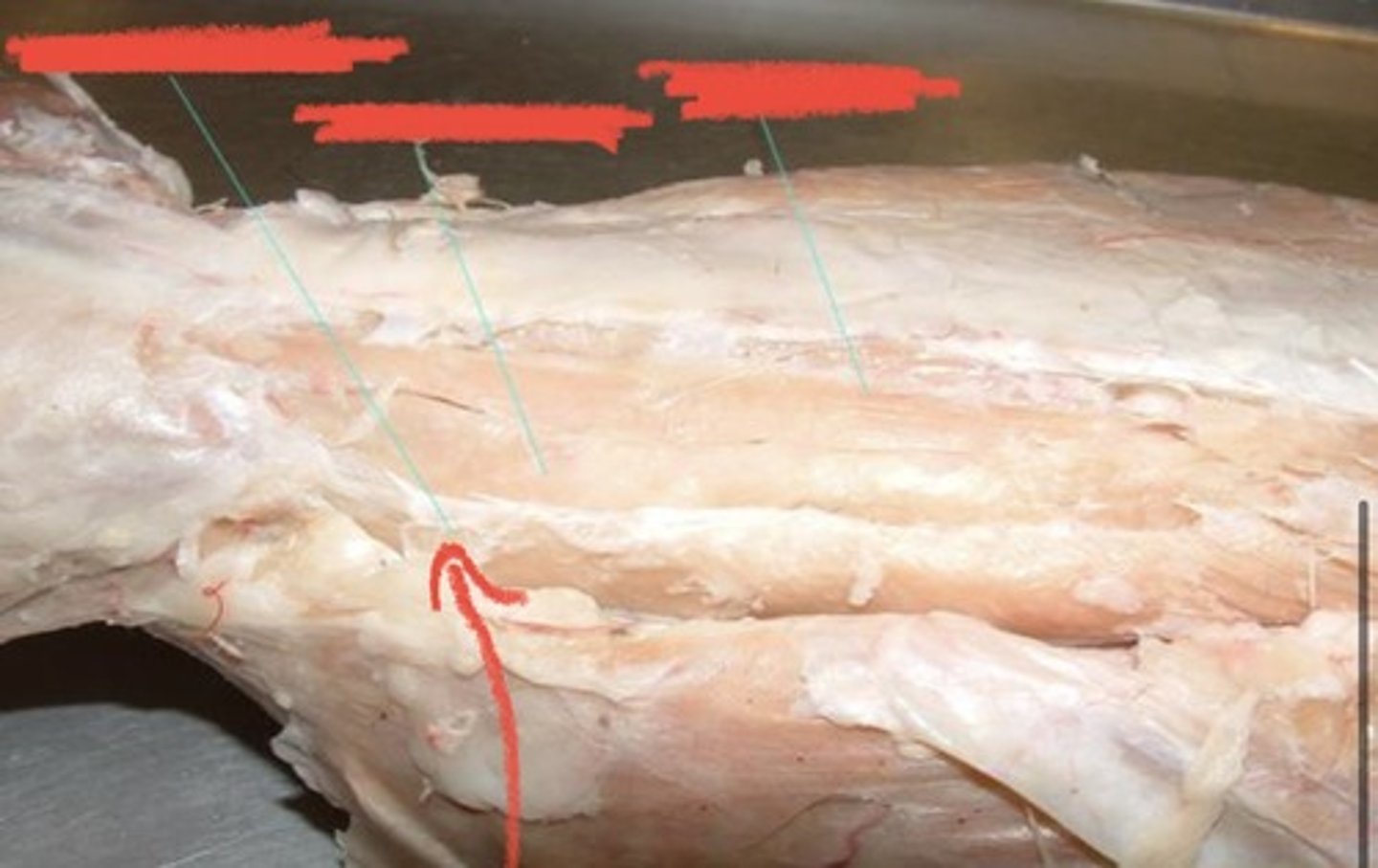 <p>Origin: muscle bundles from lower thoracic ribs</p><p>Insertion: three ribs craniad to the origin of each bundle</p><p>Action: draws ribs together</p>