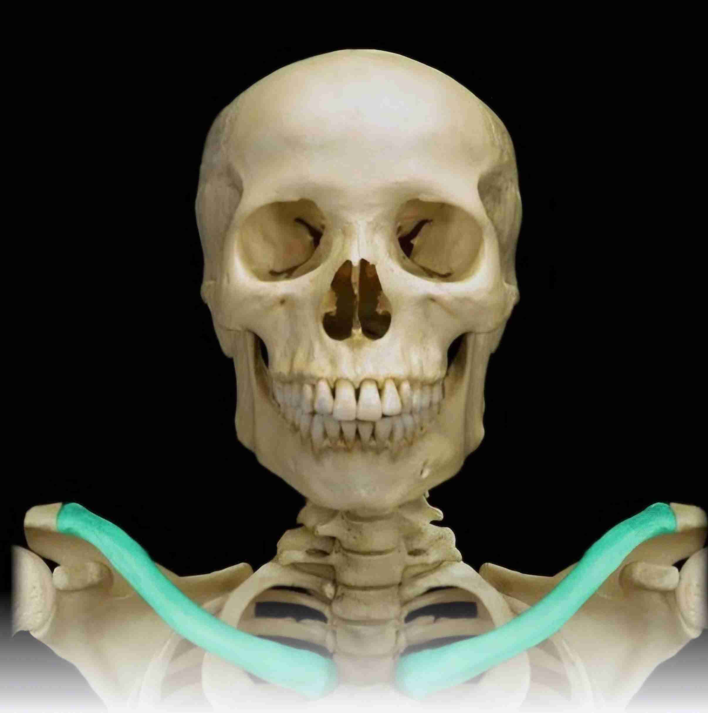 <p>What bone is this?</p>