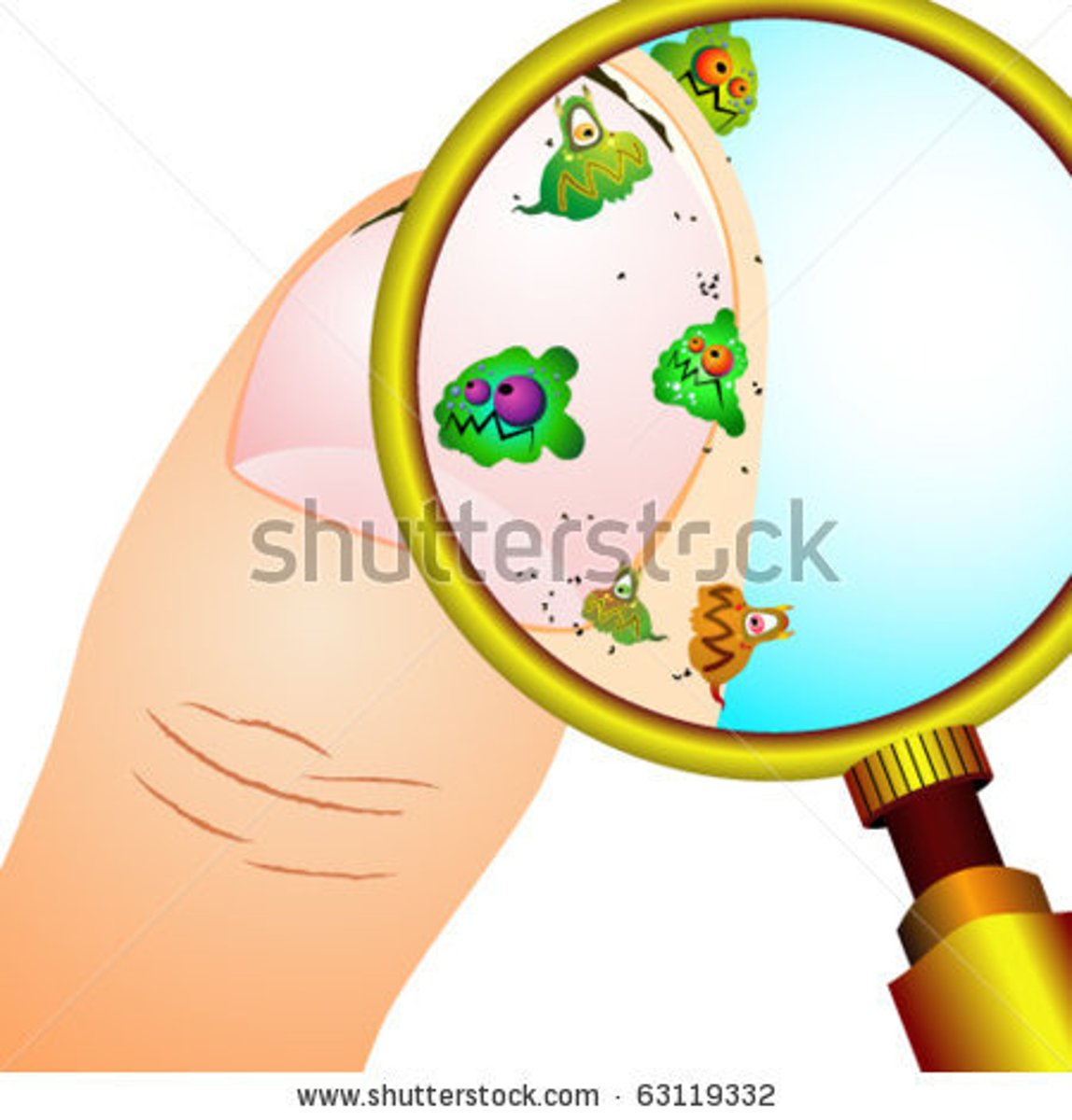 <p>Now it's infected.</p>