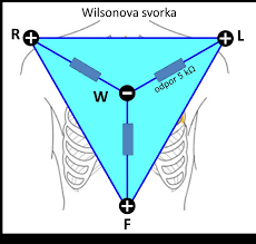 <p>bipolární svody</p><ul><li><p>zachycují potenciálový rozdíl mezi dvěma aktivními elektrodami</p></li><li><p>např. končetinové svody (Einthovenův trojúhelník)</p></li></ul><p>unipolární svody</p><ul><li><p>zachycují potenciálový rozdíl mezi aktivní a indiferentní elektrodou (slouží jako referenční bod)</p></li><li><p>např. Wilsonova svorka - spojení všech tří aktivních končetinových elektrod do jednoho bodu přes rezistory</p></li></ul><p></p>