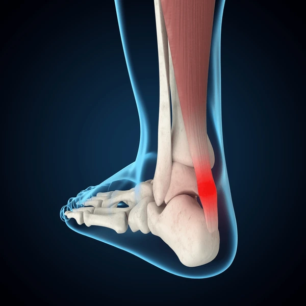 <p>Back of ankle; </p><p>thick cord </p><p> 'Achilles heel'</p>