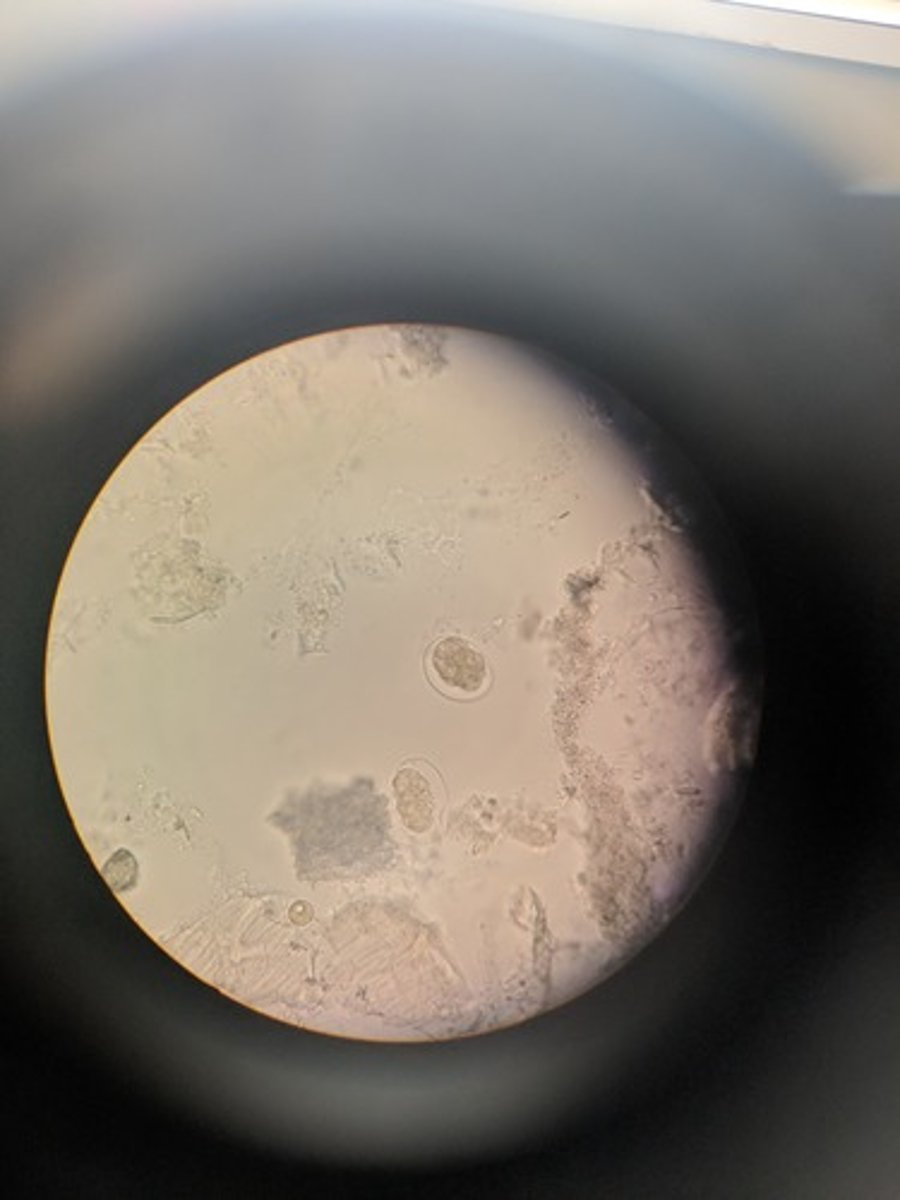 <p>Larvae = infective form</p><p>dx: fecal exam for eggs</p>