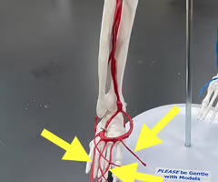 <p>Name the blood vessel.</p>