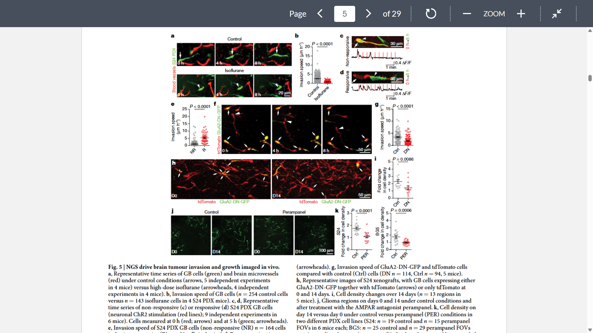 <p>Goal: analyze the consequences of NGS and its effect on tumor growth</p><p>Shows that isoflurane treatment visibly slows invasion of tumor microtube-bearing GB cells</p>