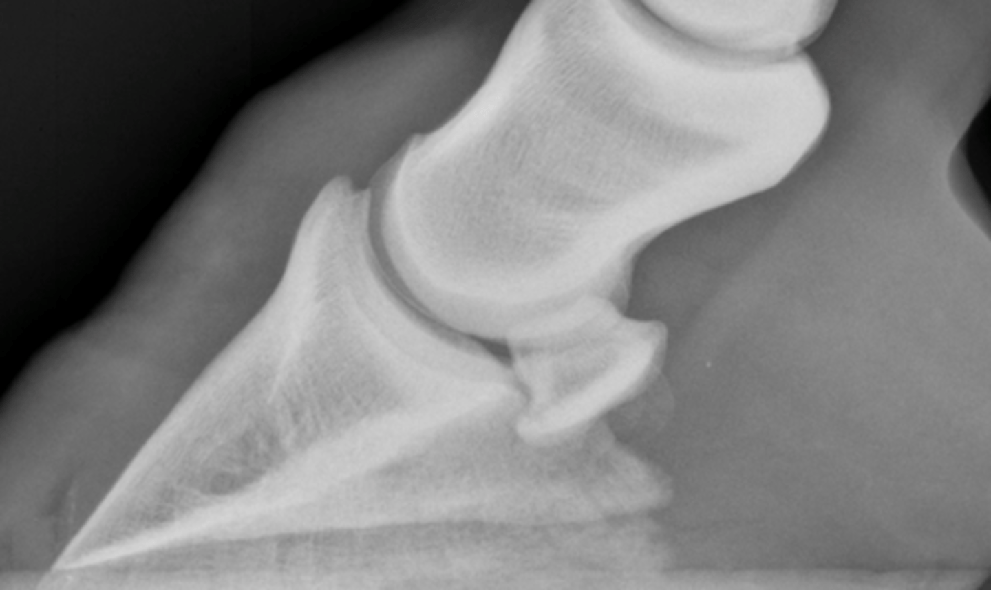 <p>What is highlighted in LM views of the foot?</p>