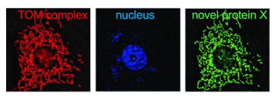 <p>you have identified a novel protein (x) thru a functional screen. since you dont have an antibody, you tag the cDNA of this protein with GFP. In colocalization studies in which you also use an antibody to the TOM complex (together with the correct secondary antibody with a red fluorophore. which of these conclusions is best supported by result? </p>