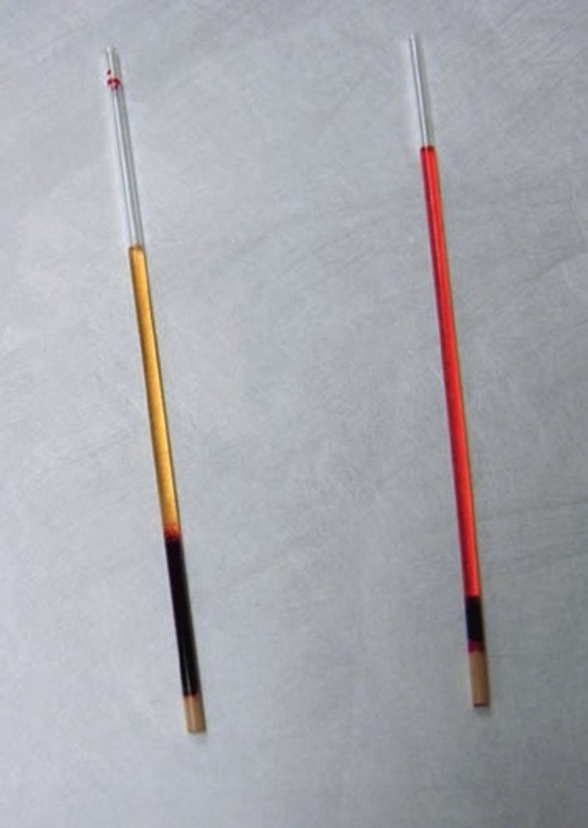 <p>It indicates hemolysis.</p>