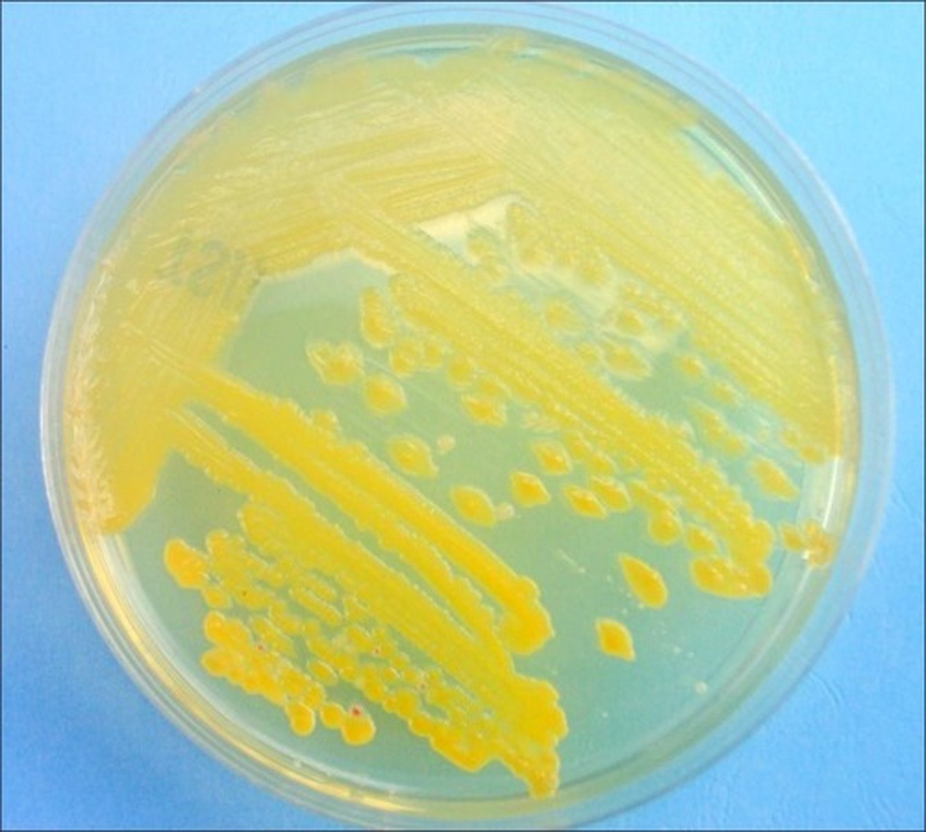 <p>Error in streaking:</p>