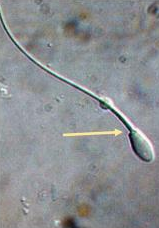 <p>Identify the sperm morphology.</p>