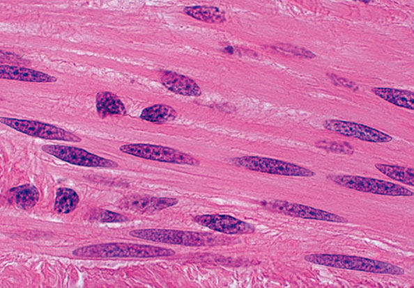 <p>which type of muscle is this?</p>