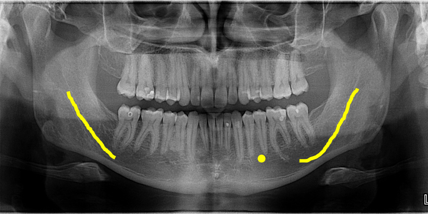 <p>what is this, its description and its appearance on images</p>