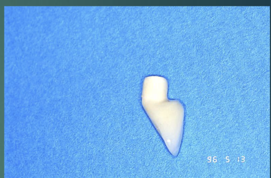 <p>good emergence profile?</p>