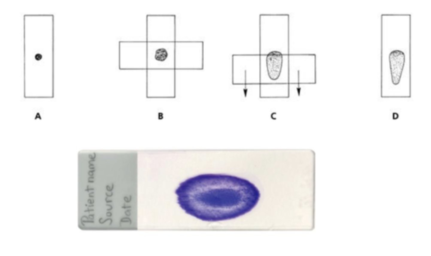 <p>What method is this?</p>