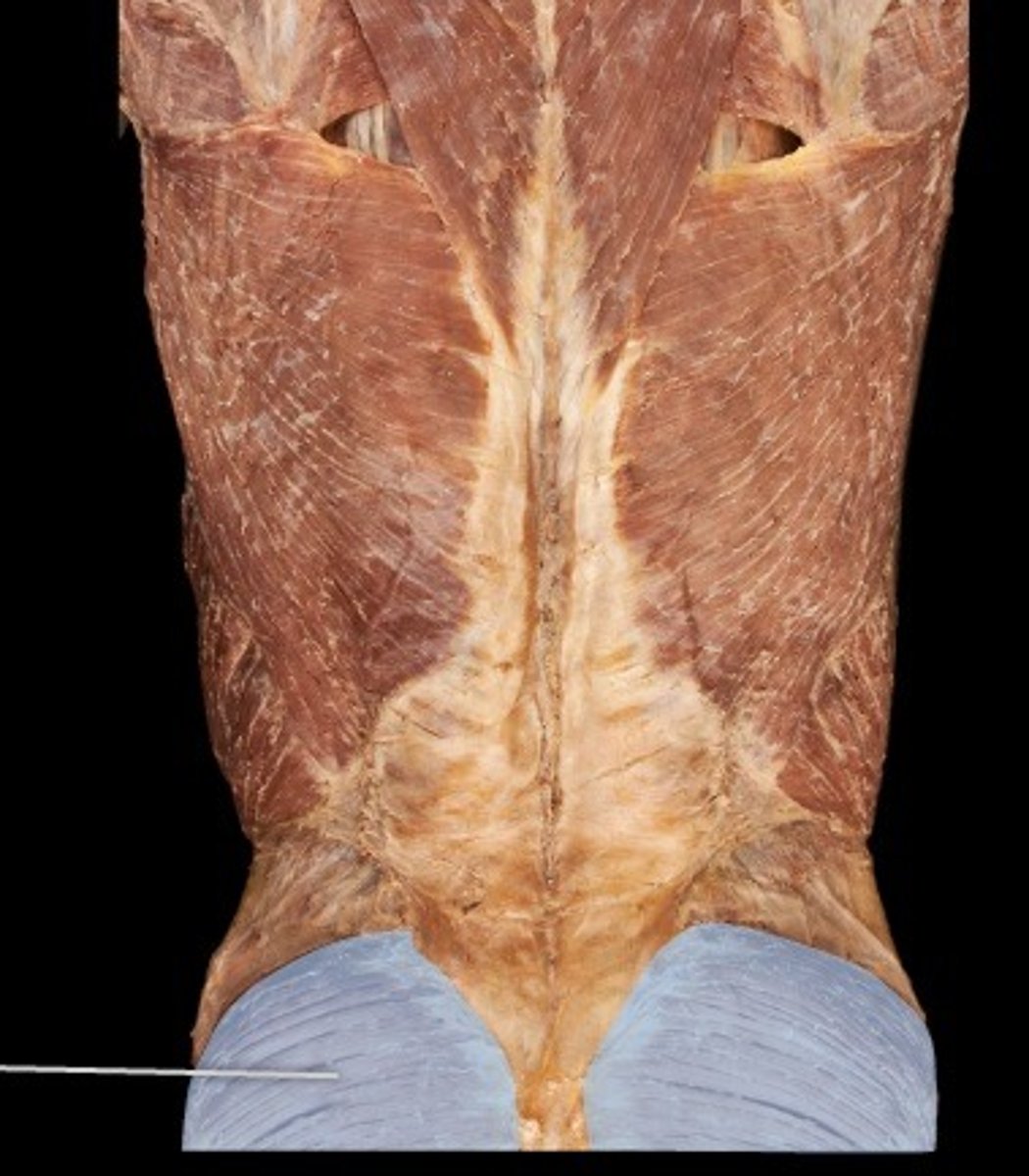 <p>What muscle is this?</p>
