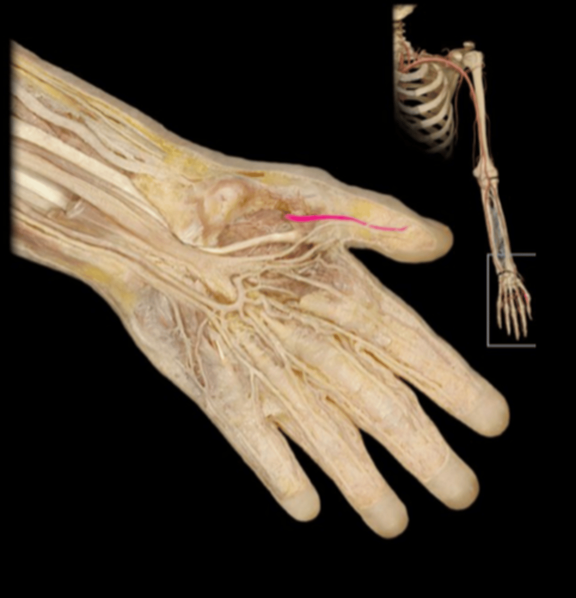 knowt flashcard image