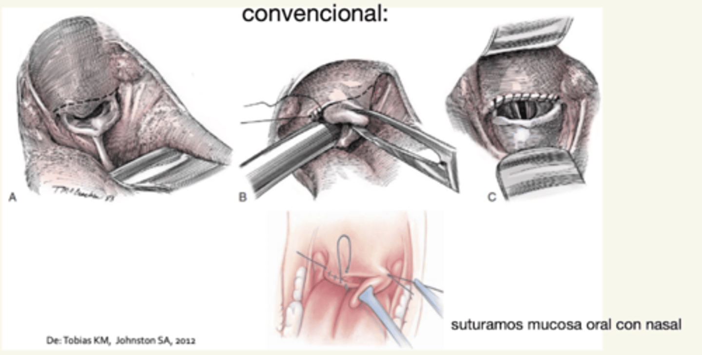 <p>resección del exceso del paladar blando en pacientes con síndrome braquicefálico</p>