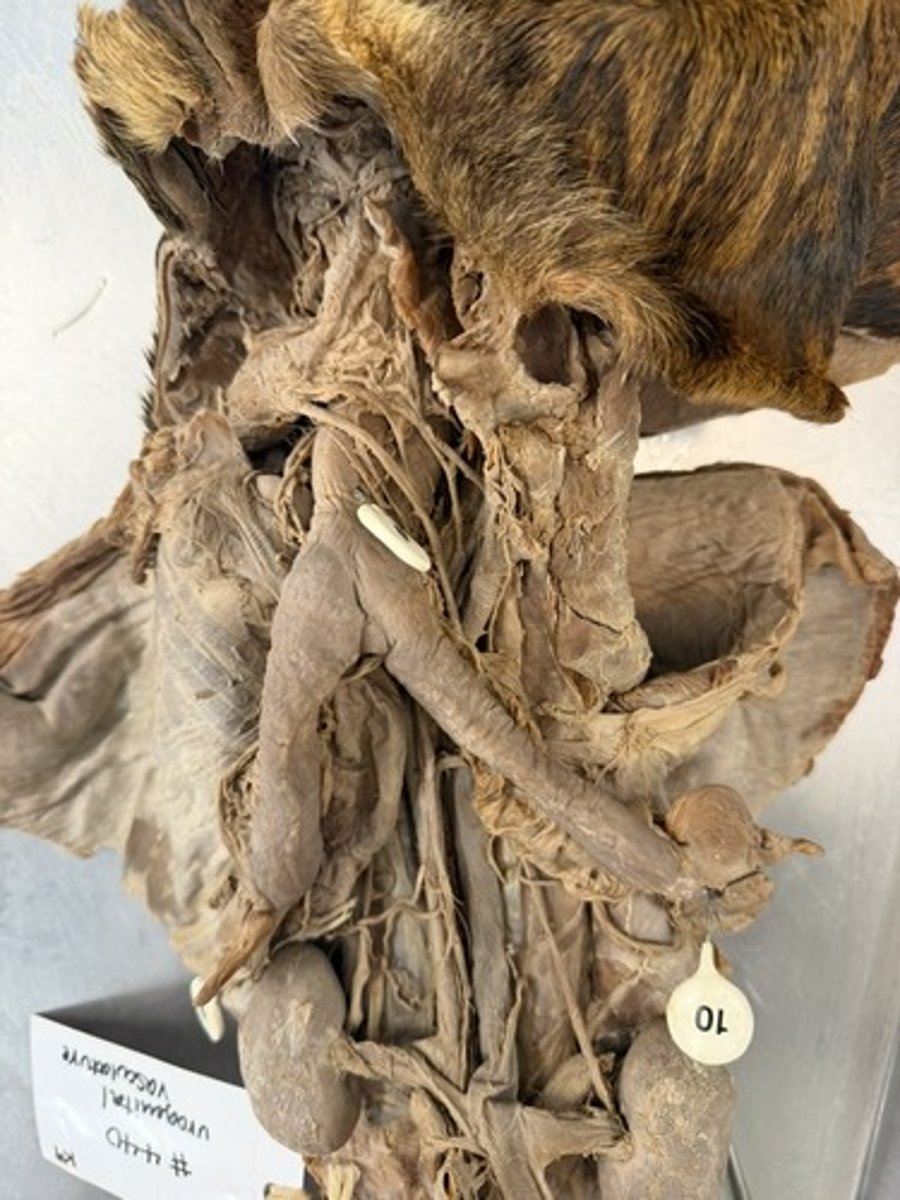 <p>A. ID the artery that supplies this region.</p><p>B. What is the parent of this vessel?</p>