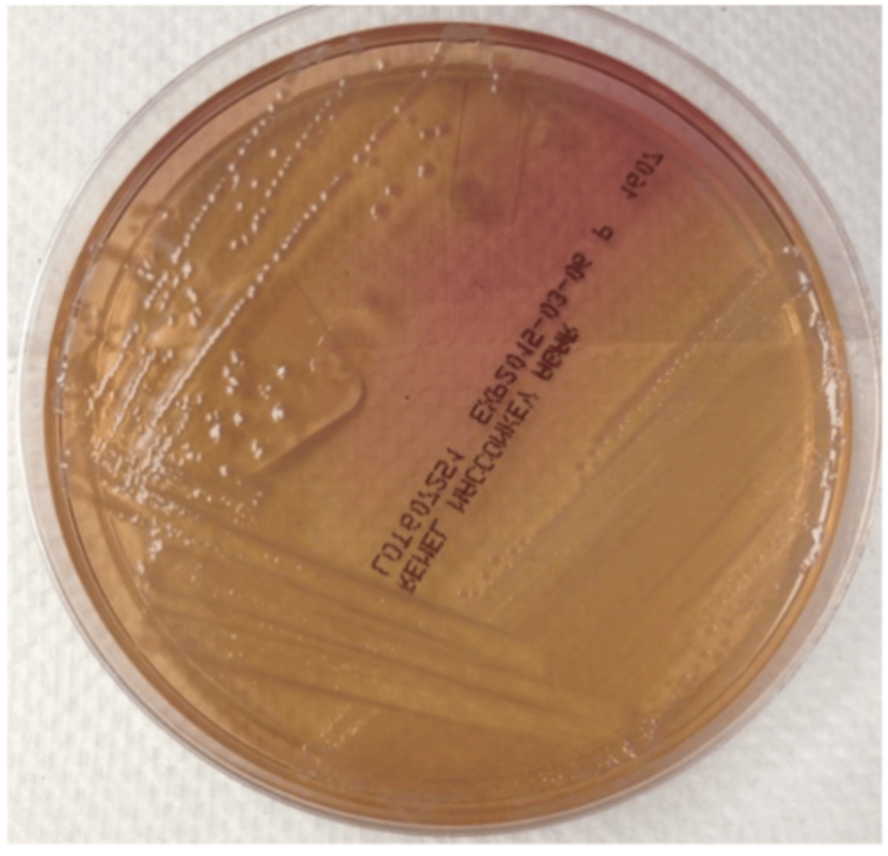 <p>which enterobacteria causes this result on Macconkey agar?</p>