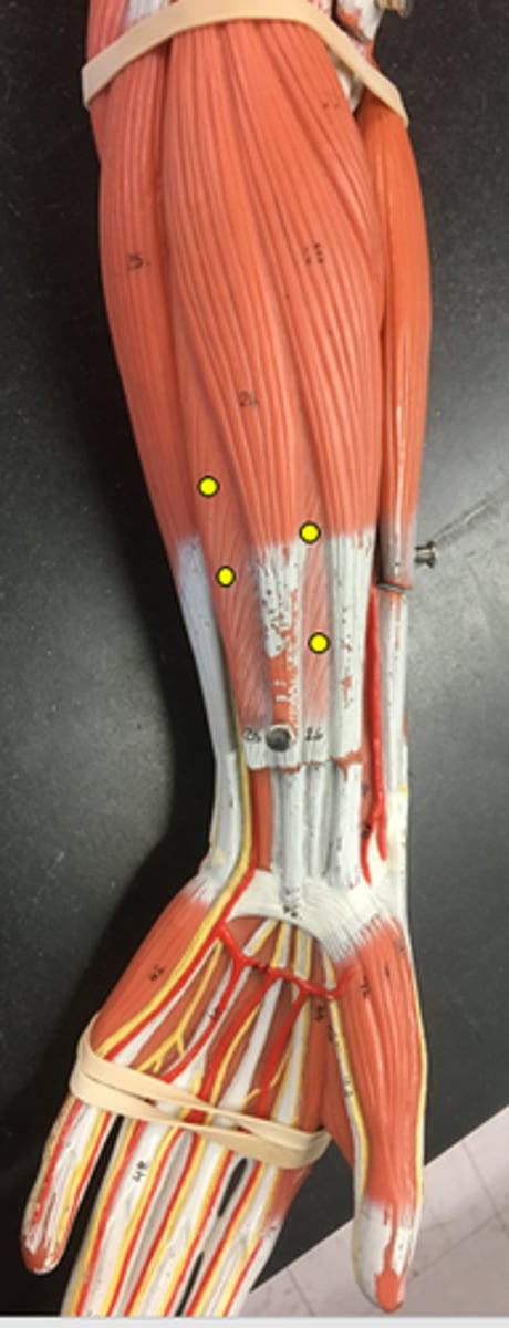 <p>Underneath the palmaris longus</p>