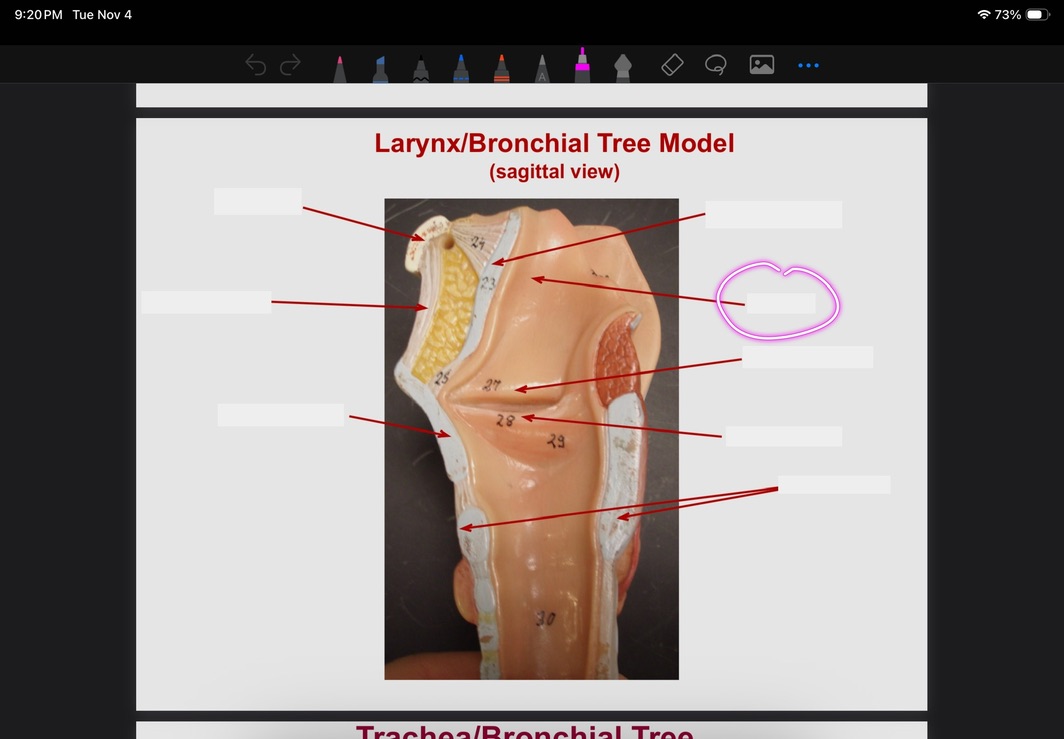 <p>What is this?</p>