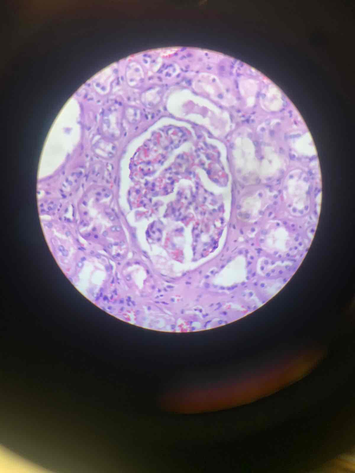 term image