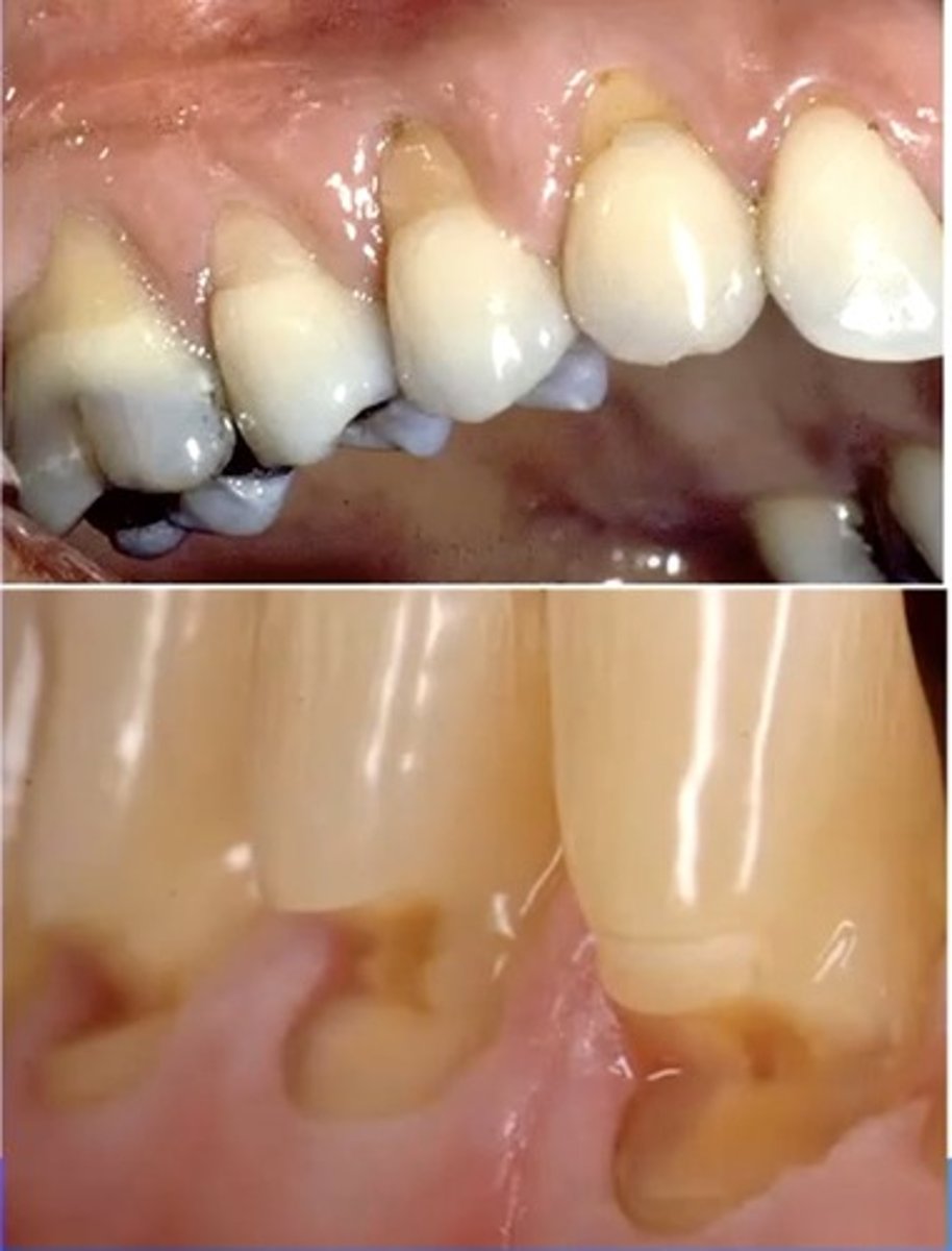 <p>identify the type of differential diagnosis</p>