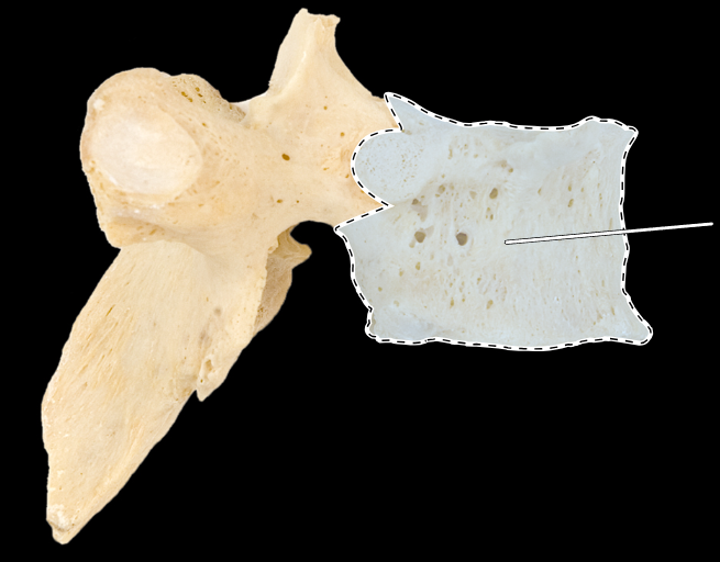 <p>What part of the vertebra is highlighted?</p><p>What type of vertebra is this (which region is this vertebra from)?</p><p>(Lateral view, right side).</p>