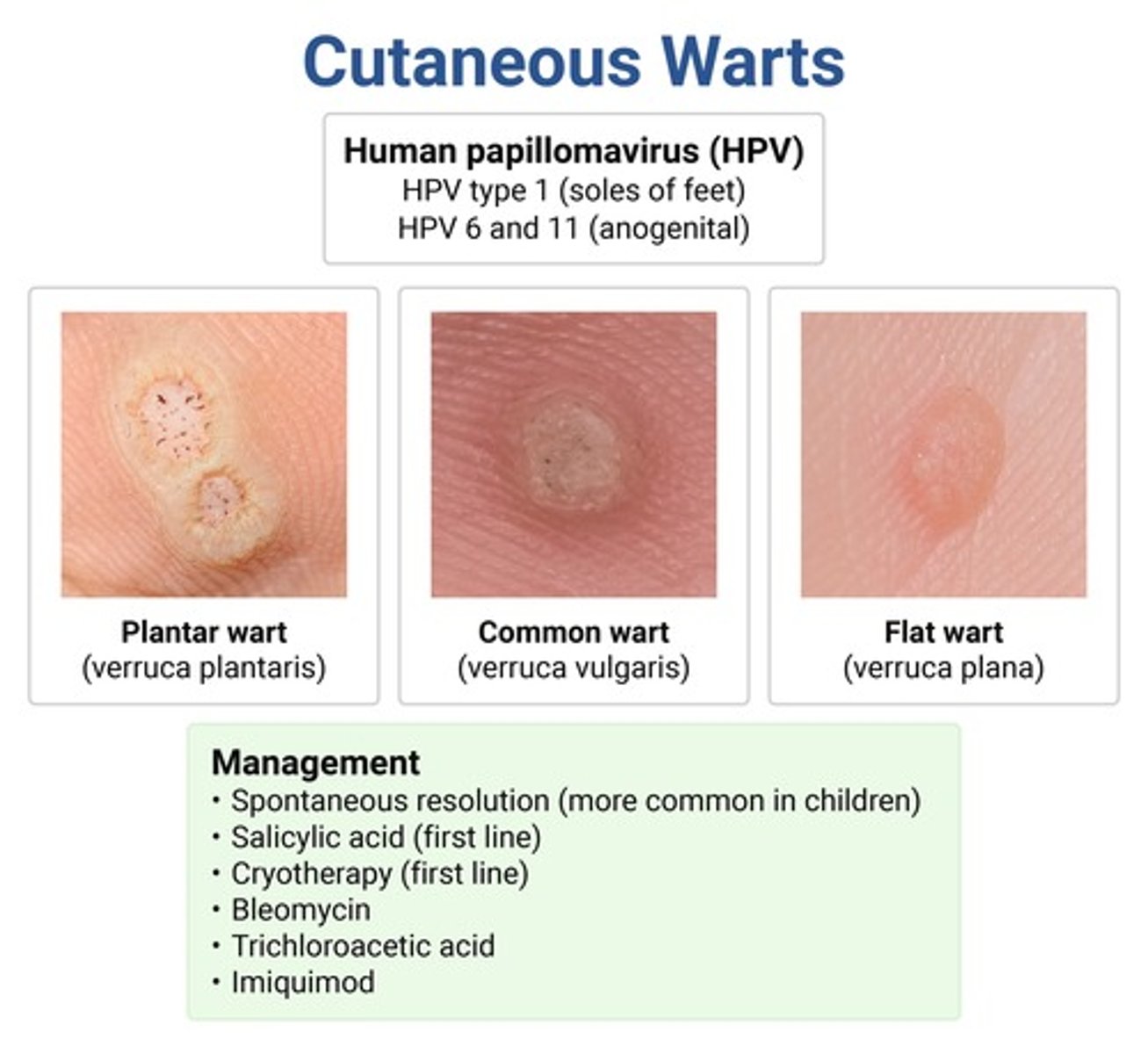 <p>plantar → painful, hyperkeratotic papules w central depression on bottom of foot; HPV 1</p><p>common (verruca vulgaris) → skin-colored papillomatous papules; distorts skin lines; HPV 2 &amp; 4</p><p>flat (verruca plana) → skin-colored papules w smooth surface</p><p>anogenital (condyloma) → cauliflower-like; HPV 6 &amp; 11</p><p>**HPV vax only protects against anogenital HPV types, not any of the others</p>