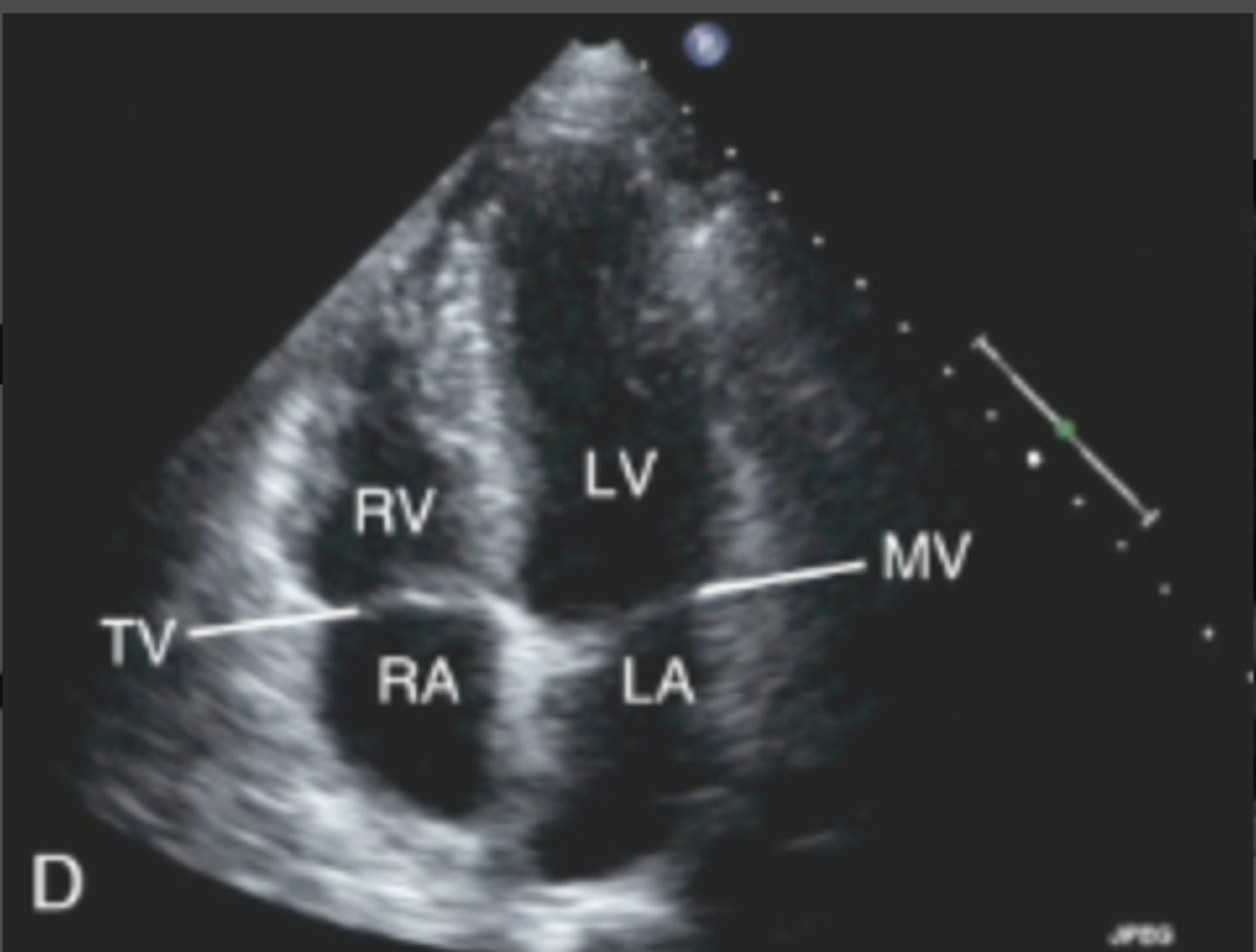<p>which imaging mode is illustrated below?</p>