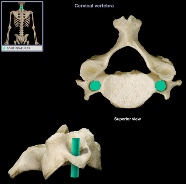 <ul><li><p>Location: Cervical vertebra, Transverse process</p></li><li><p>Description: Foramen in each transverse process</p></li><li><p>Comment: Vertebral artery passes through transverse foramina of C1-6 vertebrae (not through C7 transverse foramen)</p></li></ul><p></p>