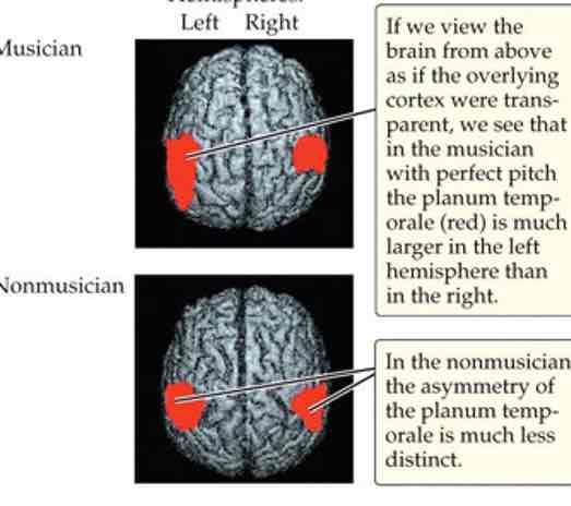 <ul><li><p>Musicians have larger neural response to pitch info than non-musicians (shown for both musical &amp; speech sounds)</p></li><li><p>Musician’s brains look different &amp; respond differently to music (activation of motor regions when listening to familiar piece)</p></li></ul>