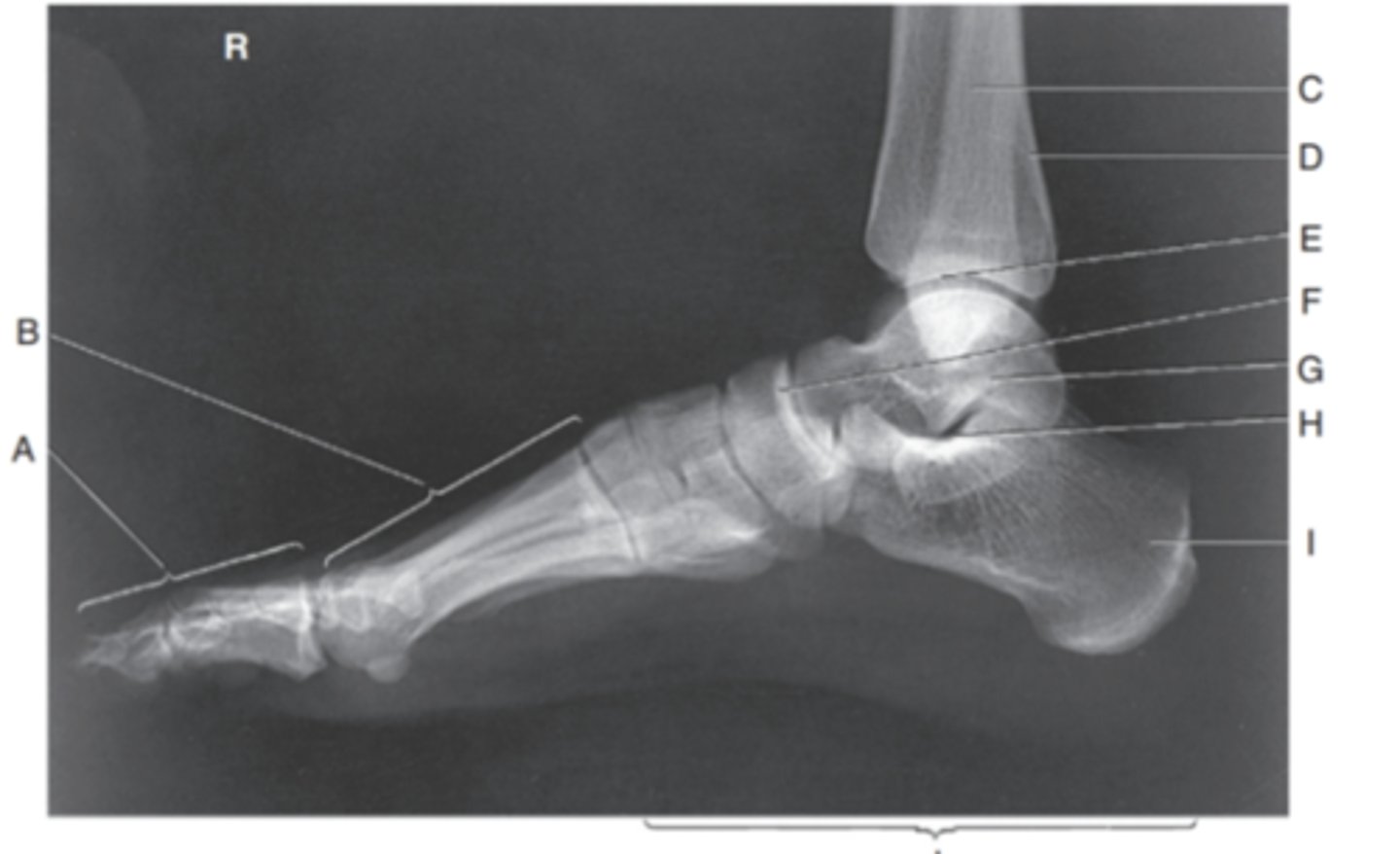 <p>(LATERAL FOOT) what is A?</p>