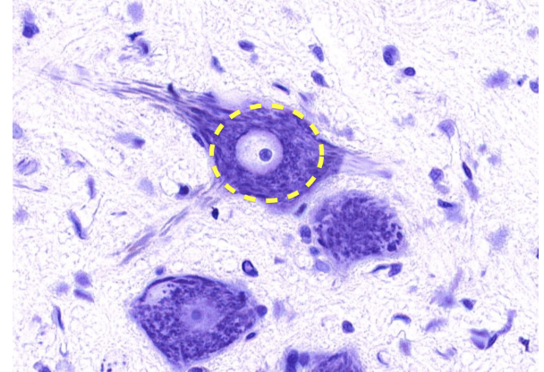 <p><span><span>Carefully observe the image below and pay special attention the the area denoted by the yellow circle.&nbsp; Then, select all of the statements below that would be true of this area.</span></span></p>